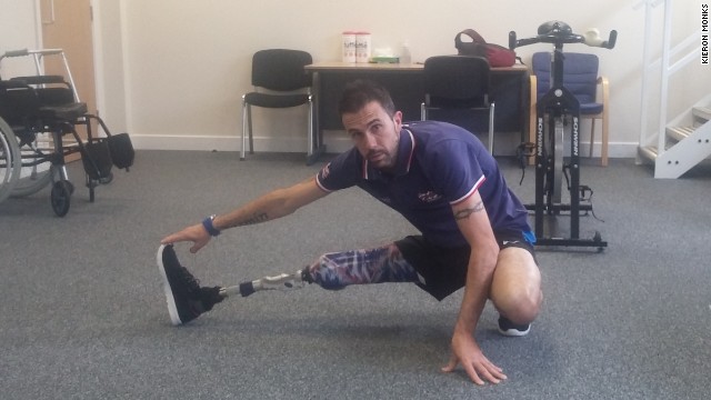 Para-triathlete Andy Lewis uses Ottobock's S380 leg, the first above-the-knee prosthetic specialized for running.