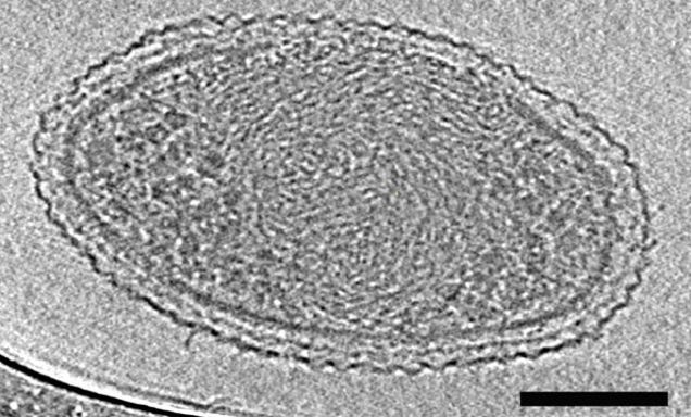 The First Detailed Image of the World's Smallest Known Life-form