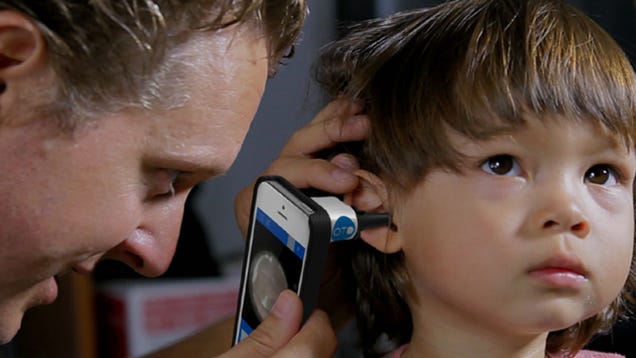 Smartphone Cameras Could Help Diagnose Ear Infections Right at Home
