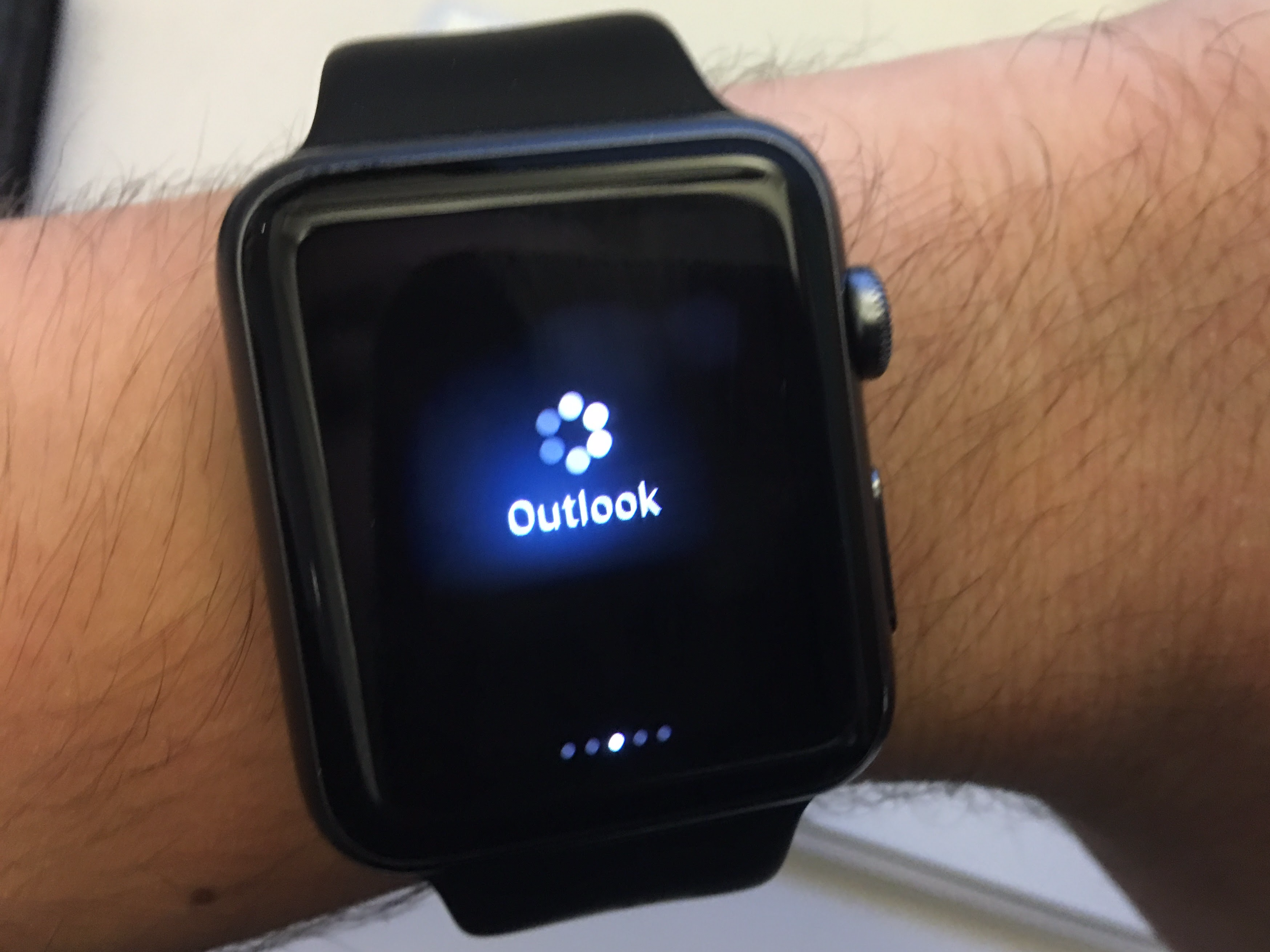 Apple Watch glance taking forever to load
