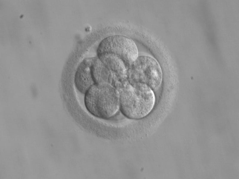 human embryo blastocyst