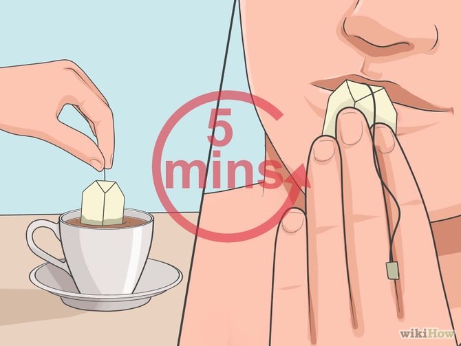 Heal a Cold Sore Naturally Step 10 Version 2.jpg