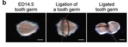 We're One Step Closer to Being Able To Regrow a Lost Tooth