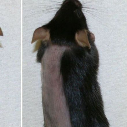 There's a new drug to treat some types of baldness - and it actually works