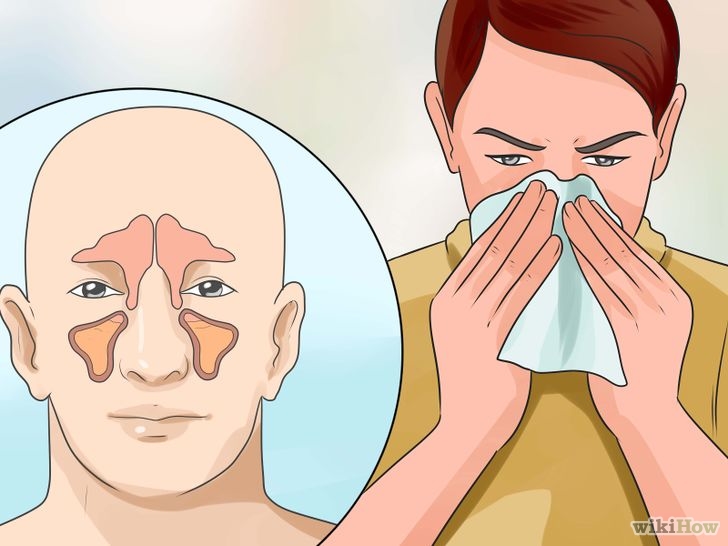 Get Rid of a Runny Nose Step 1 Version 3.jpg