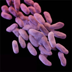 Carbapenem-resistant Enterobacteriaceae (CRE) bacteria