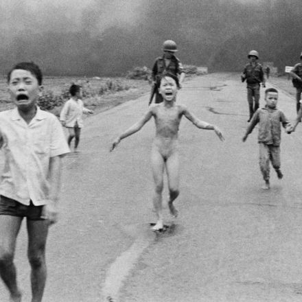 Girl in Vietnam napalm photo receives medical treatment for burns 50 years later