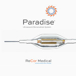 ReCor Medical's Paradise renal denervation system