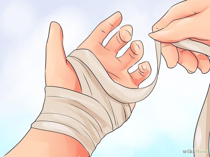 Exercise After Carpal Tunnel Surgery Step 7.jpg