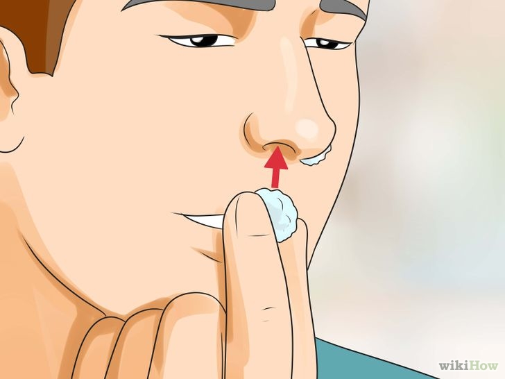Get Rid of a Runny Nose Step 13 Version 3.jpg