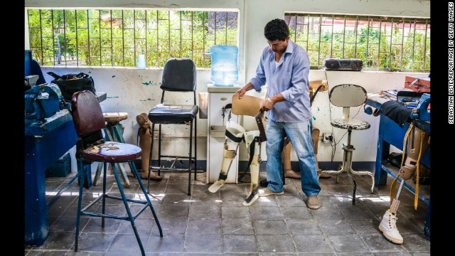 A technician works in the rehabilitation center at the Aldo Chavarria Hospital in Managua.