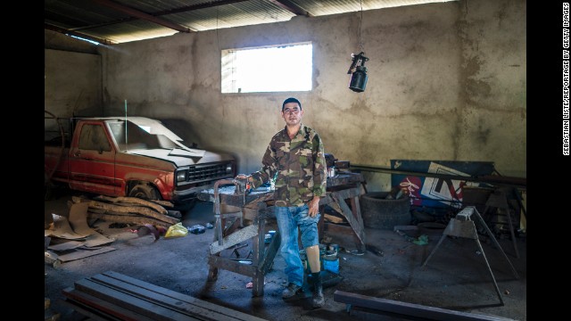 José Luís López Casas lost his left leg to a land mine near the Nicaragua-Honduras border in 1987. Now he works as an industrial mechanic.