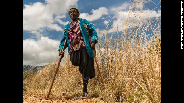 Requina Jimu lost her leg in 1987 to a land mine laid by Rhodesian forces at the Mozambique-Zimbabwe border in the 1970s. Her husband was killed by a land mine a year later. "Everything changed when I lost my leg," she said. "Now I am a beggar."
