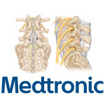 Medtronic's DIAM spine system