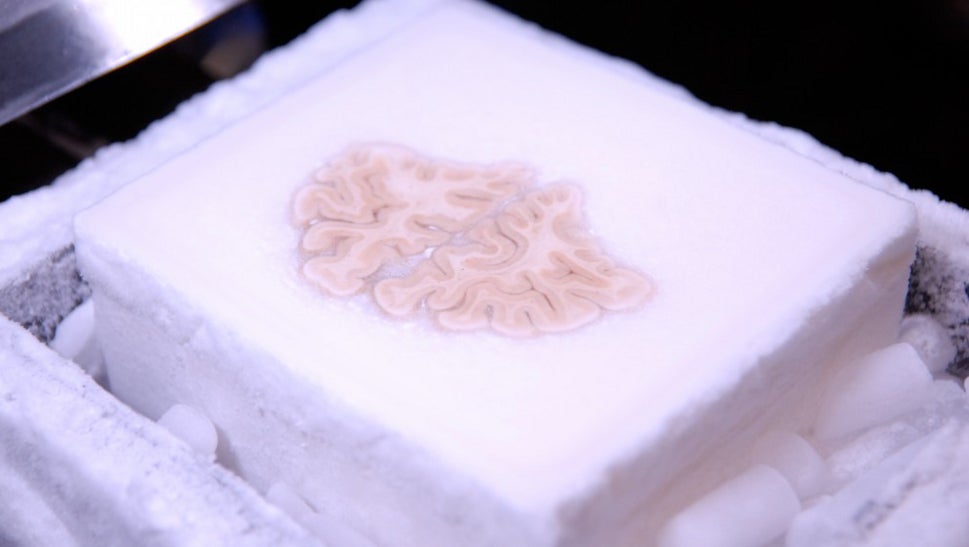 This famous brain was cut into 2,400 slices and uploaded to the cloud