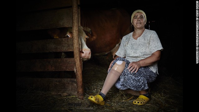 Zilka Durmisevic was injured by a land mine in 1999 while she was cleaning her parents' house in the Bosnian village of Kamenica. Her leg had to be amputated below the knee. Land mines remain a threat in many areas around the world that were once war zones.