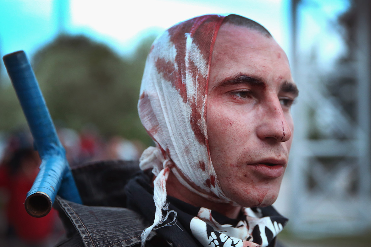 A wounded pro-Russian activist joins other activists after clashing with pro-Ukrainian supporters during a rally and march in Donetsk.