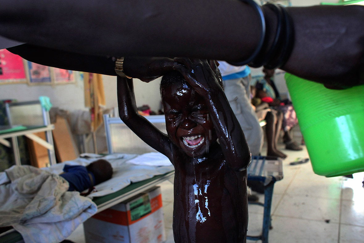 A South Sudanese child displaced by the fighting in Malakal, and suffering from malnutrition, cries as he is washed by a nurse at a feeding centre run by Medicins sans Frontiers (MSF) in Kodok, Fashoda county