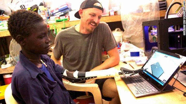 Ebeling traveled to Sudan in October 2013, and used a 3-D printer to fabricate a prosthetic arm for Daniel.