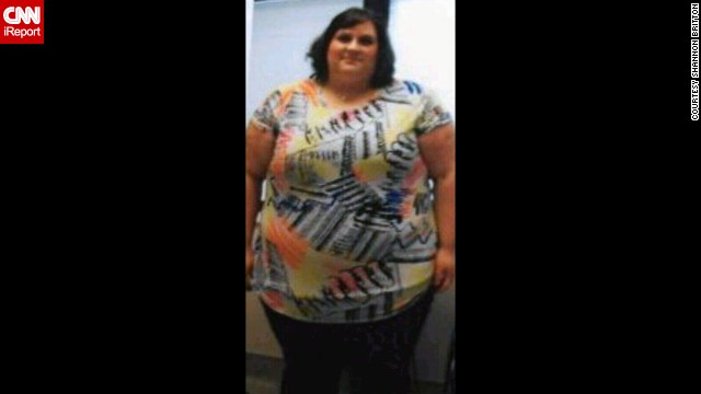 At her heaviest in 2011, Shannon Britton weighed 486 pounds. This photo was taken 10 days before her gastric bypass surgery on November 23.