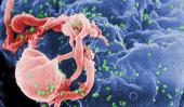Varios virus del sida (puntos verdes) atacan un linfocitos del sistema inmunitario. Wikipedia.