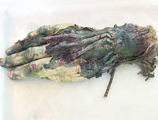 Artist Morten Viskum paints using severed hands instead of paint brushes. Art.