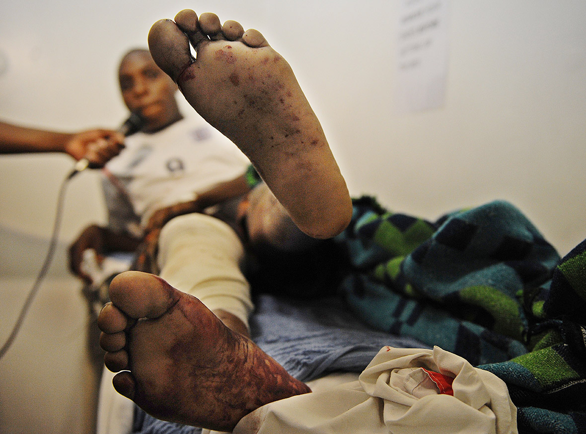 An injured man shows his wounds at a hospital near the scene of the explosion