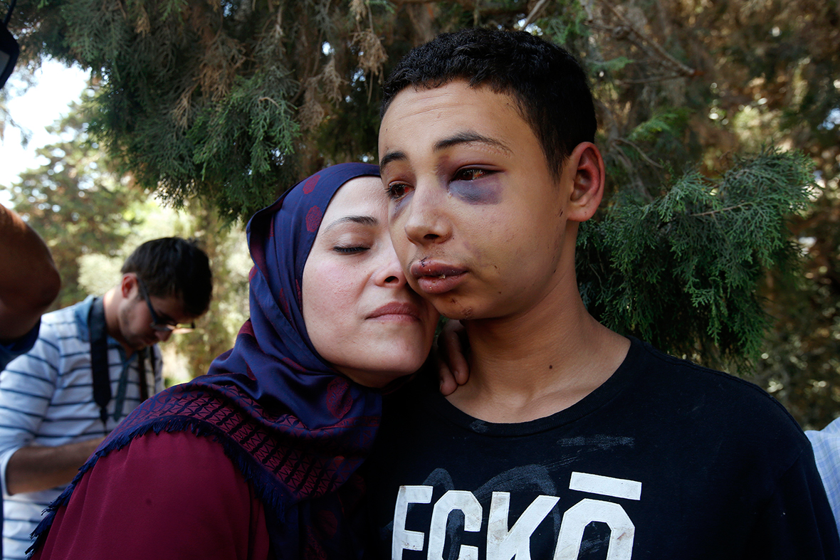 Tariq Khdeir is greeted by his mother after being released from jail in Jerusalem. Tariq Khdeir from Tampa, Florida, is a cousin of Mohammed Abu Khudeir, 16, whose abduction and killing in Jerusalem on Wednesday sparked violent protests and calls from Palestinians for a new uprising against Israel