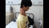 DOLOR. El joven debe ser intervenido por los inconvenientes que le causa su enfermedad (Captura video).