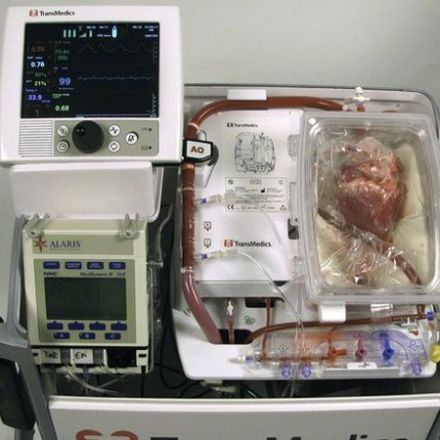 Doctors Revive and Transplant Dead Hearts