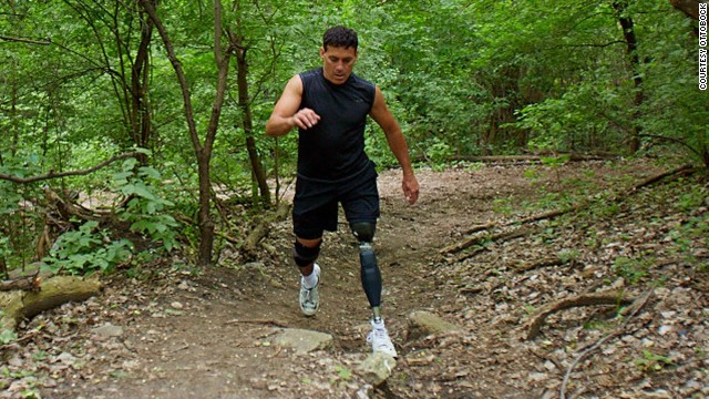 The Genium X3 - considered the most advanced prosthetic leg in the world, developed by the US military.