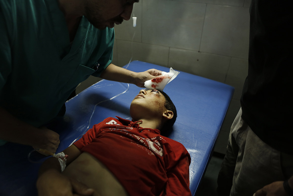 Medics treat a wounded Palestinian child in an emergency room at the al-Shifa hospital in Gaza City