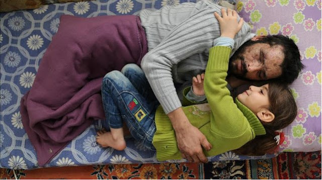 Bocah Suriah Ini Ingin Donorkan Matanya Untuk Sang Ayah, Sedih Bacanya-Redaksi Terbaru