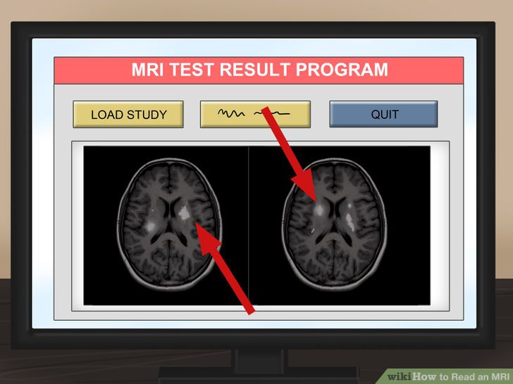 Read an MRI Step 13.jpg