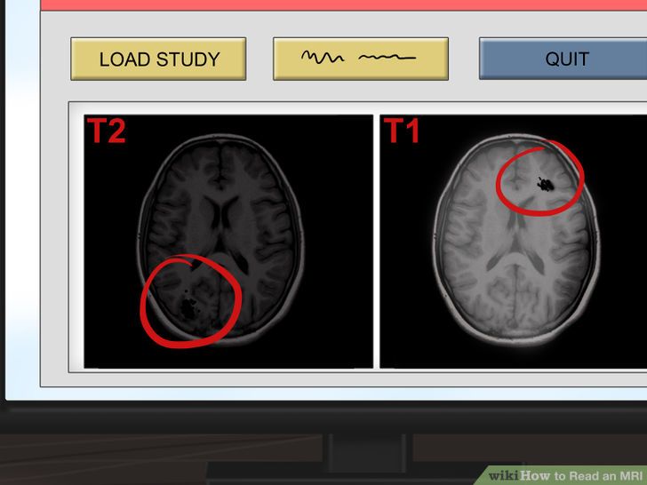 Read an MRI Step 7.jpg