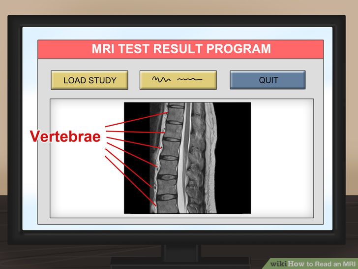 Read an MRI Step 12.jpg