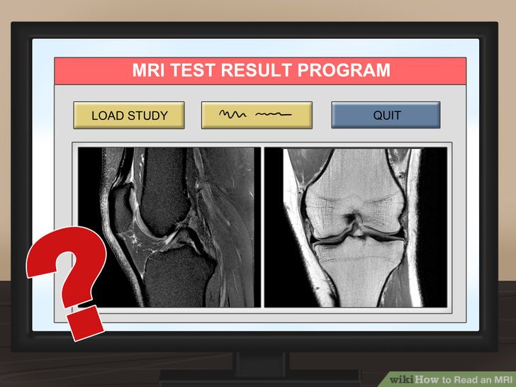 Read an MRI Step 14.jpg