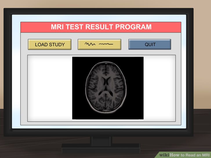 Read an MRI Step 5.jpg