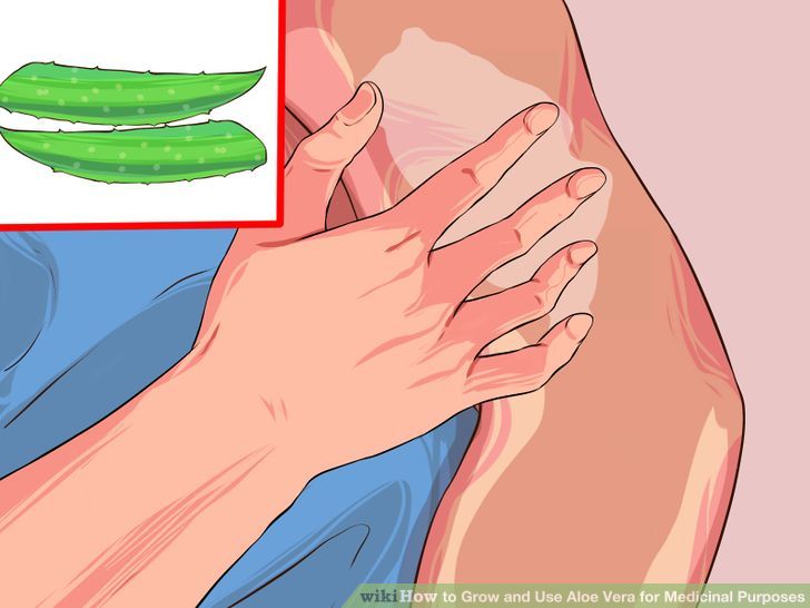 Grow and Use Aloe Vera for Medicinal Purposes Step 7 Version 2.jpg