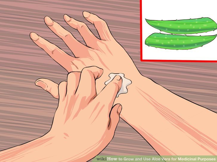 Grow and Use Aloe Vera for Medicinal Purposes Step 11 Version 2.jpg