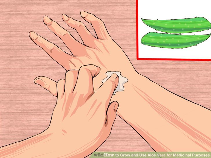 Grow and Use Aloe Vera for Medicinal Purposes Step 8 Version 2.jpg