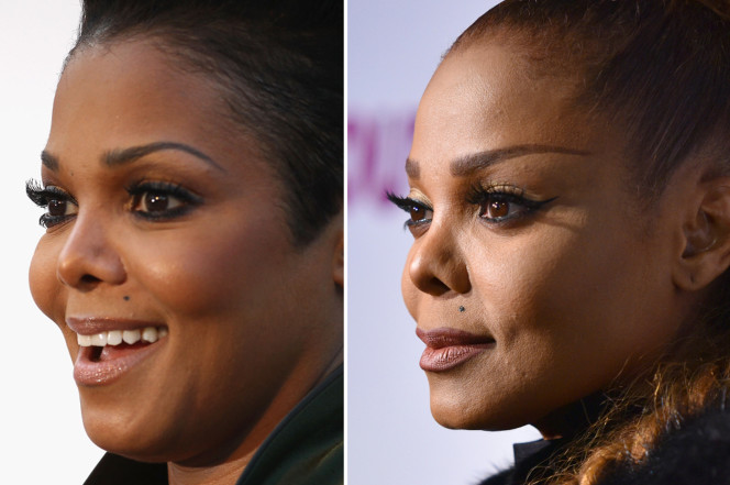 Plastic surgeon says Janet Jackson’s nose appears to be ‘collapsing’