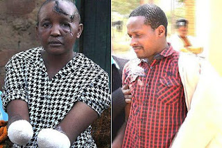 Kenyan man cuts of wife's hands in knife attack 