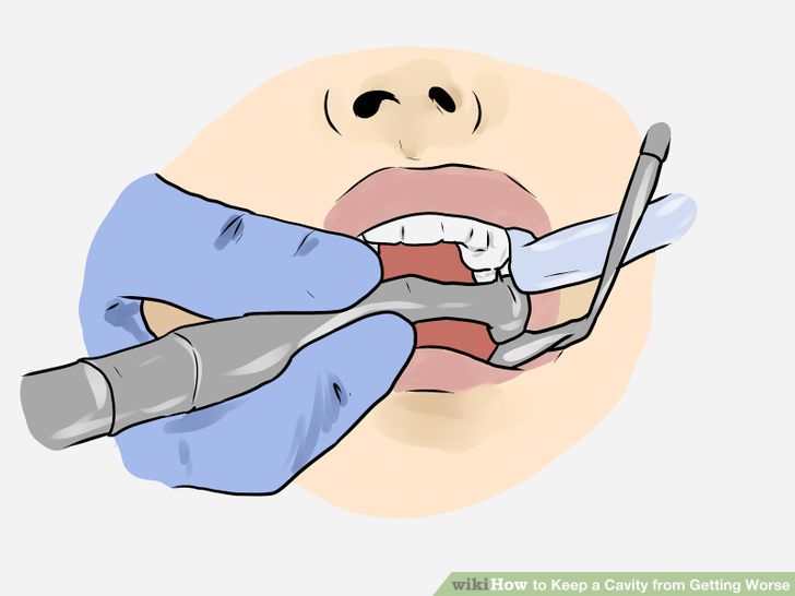 Keep a Cavity from Getting Worse Step 11 Version 2.jpg