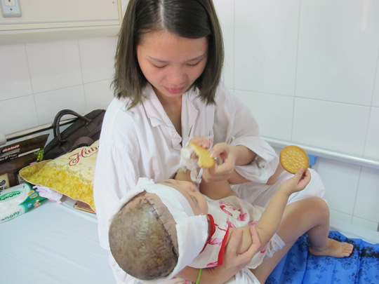 Bé gái 2 tuổi bị lột toàn bộ da đầu vì tai nạn giao thông - 1