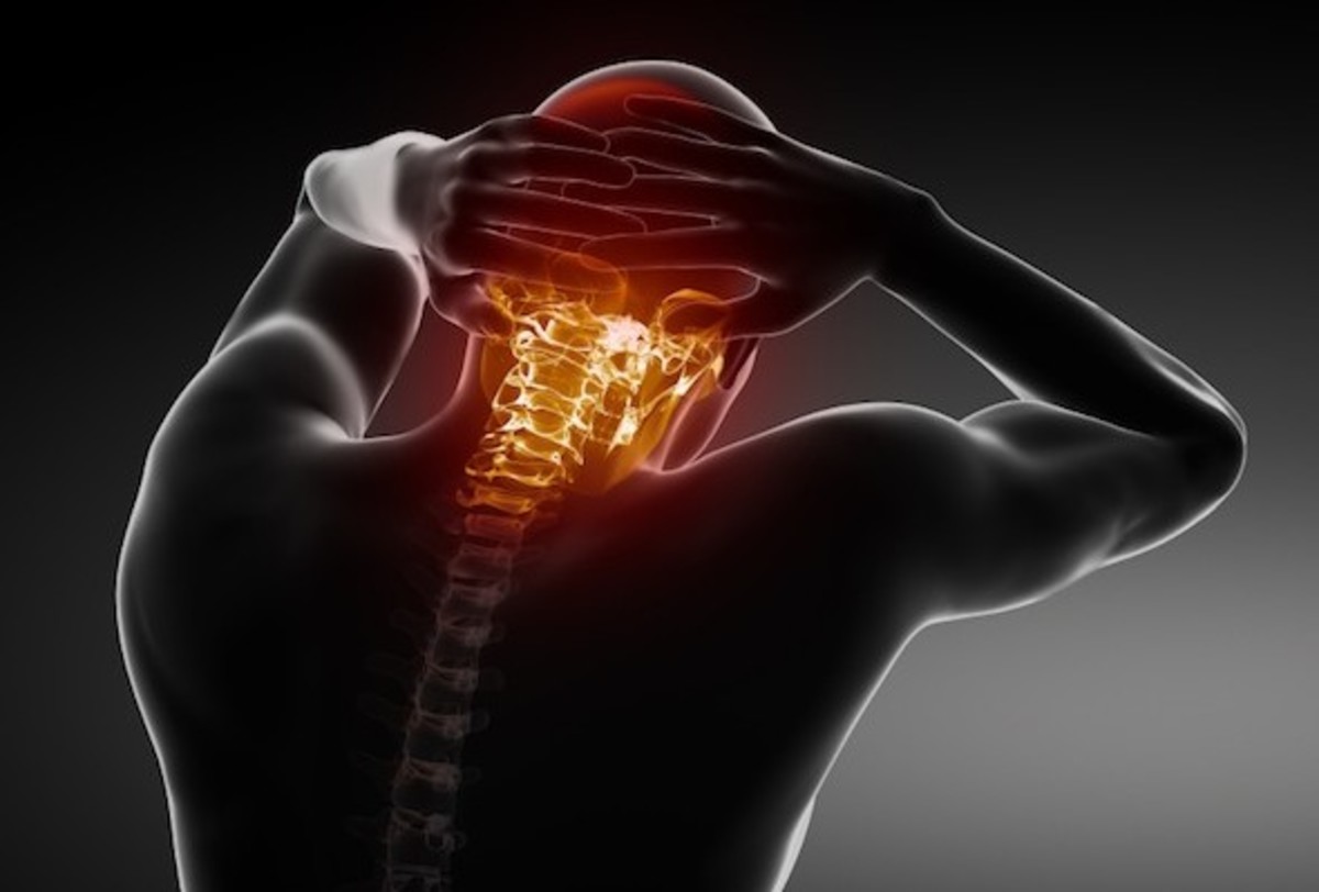 Αυχενικό σύνδρομο: Γιατί και πότε έχετε πόνους στον αυχένα | Newsit.gr