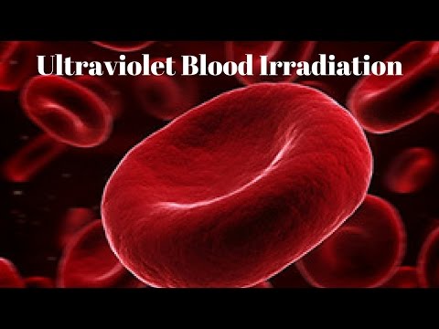 Ultraviolet Blood Irradiation