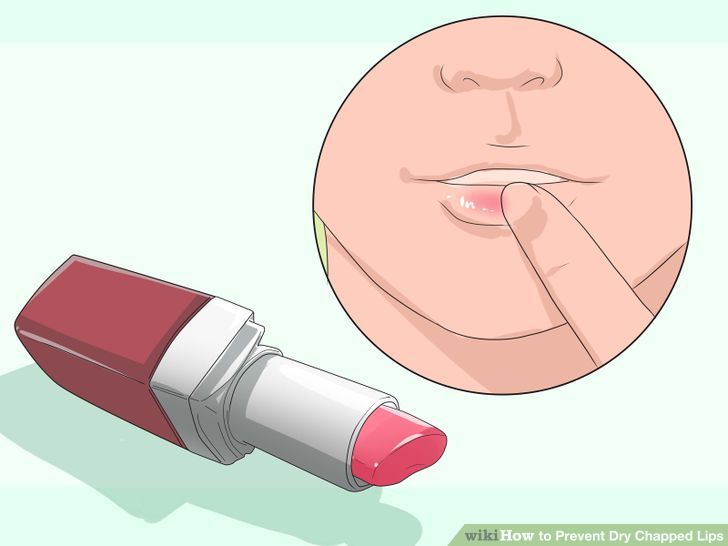 Prevent Dry Chapped Lips Step 7 Version 3.jpg