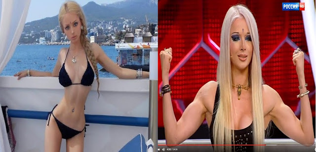 Do you Remember the 'Human Barbie'? This Is How She Looks Like Now!