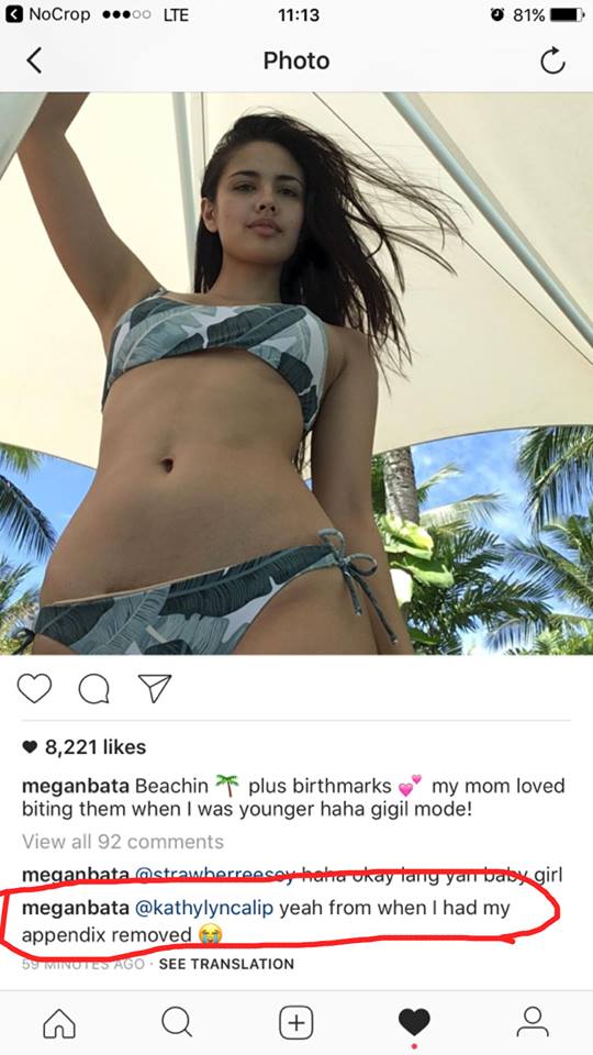LOOK! Megan Young Has Something on Her Body That Netizens Are Going Crazy About! See it Here!
